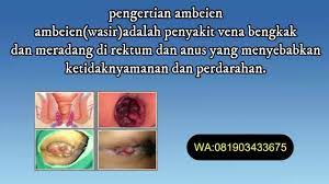 Pin Di Ambeien