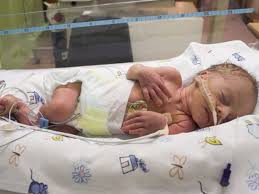 The womb is the pear shaped muscular bag that holds a baby during pregnancy. Every Day In The Womb Boosts Babies Brain Development Study
