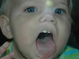 Fundraiser by Samuel Pharris : Support Samuel's Journey to Top Surgery