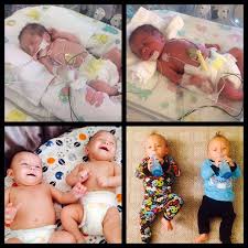 3 pounds = 48 (48). Our Littlest Fighters Before And After Photos Of Preemie Twins Twiniversity