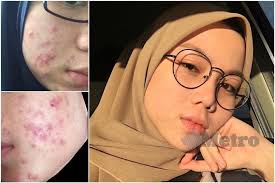 Klinik kecantikan kulit yang satu ini memang sangat populer di kalangan para mojang bandung. Bayar Rm5 Muka Cantik Dah