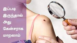 Sometimes symptoms are linked to certain cancer types. Common Cancer Symptoms And Signs Health Tips In Tamil Youtube