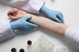 Image result for Allergy Screening