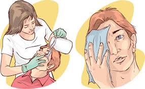 Image result for Eye Irrigation