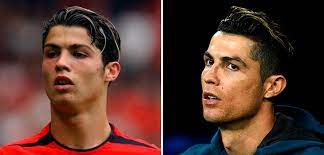 Гарет бэйл и пластика ушей Ronaldu Kolet Botoks Umenshil Nos I Peresadil Volosy Linea De Vida Blogi Sports Ru