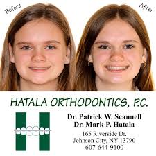 We had the joy of honoring these exceptional recipients of the Hatala  Orthodontics' Scholarship Award with a celebration breakfast at our office.  In recognition of their dedication, academic excellence, and their amazing