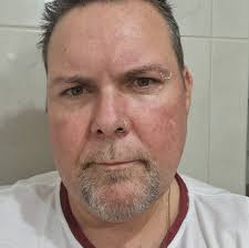 Who still has the scars 🤣😅