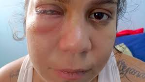 Fundraiser by Lorena Albornoz : A Franchesca Robles para una cirugía ocular