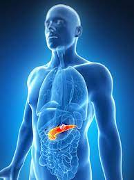 When you do get symptoms, they are often vague or you may not notice them. What Is Pancreatic Cancer Pancreatic Cancer Action Network