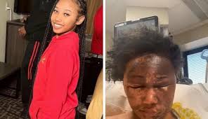 BREAKING: A third suspect has been charged with aggravated battery in the  acid attack