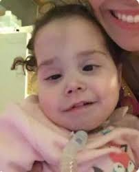 Has anyone experienced random eye drooping suddenly?