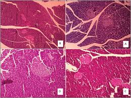 Pancreatic tissue morphology in the rat in an acute and sub-chronic...