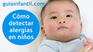 Como Reconocer Una Reaccion Alergica En Un Nino Y Cuando Llevarle A Urgencias Alergias Infantiles Youtube