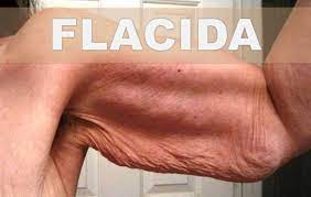 Remedios Caseros Para La Piel Colgante O Flacida Como Combatir La Pi Sagging Skin Skin Remedies Skin