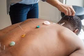 Does blue cross blue shield massachusetts cover acupuncture. 9 Best Acupuncturists In Chicago Zencare Blog