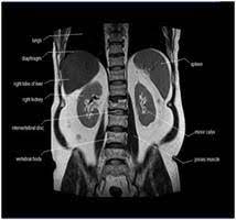 A radiologist will examine the images and send a report to your doctor. Getting Ready For Your Abdominal Mri Sansum Clinic