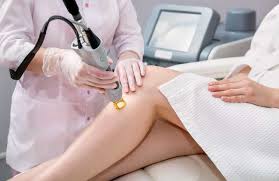 Home laser hair treatments seem to be a bit like tattoos when it comes to pain; Eliminate Unwanted Hair By Latest Laser Hair Removal Treatment