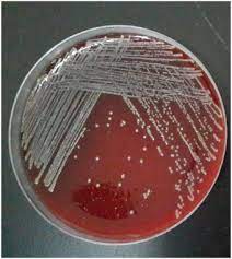 Staphylococcal infections are usually caused by the organism staphylococcus aureus. The Characteristics Of Staphylococcus Aureus Small Colony Variant Isolated From Chronic Mastitis At A Dairy Farm In Yunnan Province China