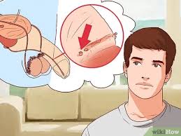 The only truly reliable way to tell if you have an std is to get tested. 5 Ways To Check A Penis For Signs Of Sexual Infection Wikihow