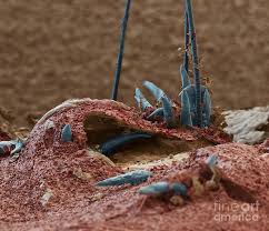 Image result for Demodex folliculorum