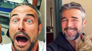 Calciatori · conduttori · attori. Flavio Montrucchio Ha Fatto Il Trapianto Di Capelli Le Foto Prima E Dopo