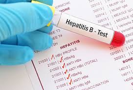 Sep 08, 2020 · hepatitis b is an infection of your liver.it's caused by a virus. What Is The Normal Range For Hepatitis B Surface Antibody