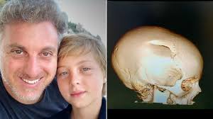 Huck Choca Com Imagem Do Cranio Do Filho E Diz Que Ele Estava Sem Capacete 26 06 2019 Uol Tv E Famosos