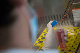 L'organisation mondiale de la santé (oms) surveille un nouveau variant du coronavirus, baptisé mu, qui a été identifié pour la première fois . Ew0l57pnsrgddm