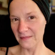 Fundraiser for Jen Kortie by Eric Fierst : Jen Kortie fundraiser