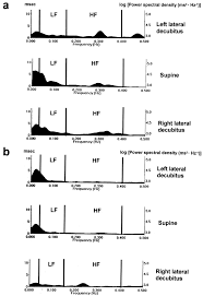 Maybe you would like to learn more about one of these? Effects Of Posture On Cardiac Autonomic Nervous Activity In Patients With Congestive Heart Failure Sciencedirect