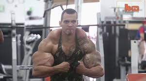 Bodybuilders pectoral muscle rips during bench press. This Brazilian Man Almost Lost His Arms After Injecting Them With Oil And Alcohol