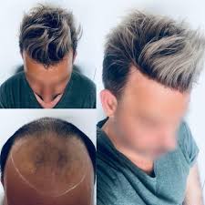 Découvrez nos offres cheveux homme, achetez en ligne sur ≡ sephora.fr et bénéficiez de la ▷ livraison gratuite en magasin! Faux Cheveux Pour Homme Off 72 Cheap Price
