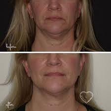 Susan Goode Estep (@drsusanestep) • Instagram photos and videos