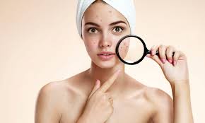 Namun untuk membantu mempercepat prosesnya, ada beberapa cara yang bisa anda coba. 7 Produk Krim Paling Best Untuk Cepat Kecutkan Jerawat Bajet Bawah Rm30 Patut Dimiliki Hijabista