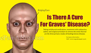 I had graves disease and i took acupuncture treatments and now it is completely cured. Is There A Cure For Graves Disease
