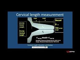How To Measure Cervical Length