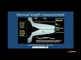 how to measure cervical length