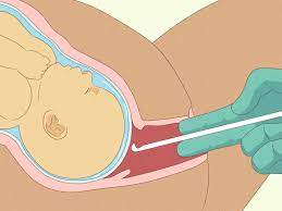 Usually as the time of labor approaches, the baby moves naturally toward the birth canal pressuring against your pelvis, making the water to break. W Vaekf1gypcqm