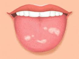 Maybe you would like to learn more about one of these? 7 Ø£Ø´ÙŠØ§Ø¡ ÙŠØ­Ø§ÙˆÙ„ Ù„Ø³Ø§Ù†Ùƒ Ø¥Ø®Ø¨Ø§Ø±Ùƒ Ø¨Ù‡Ø§ Ø¹Ù† ØµØ­ØªÙƒ Ù…ØµØ±Ø§ÙˆÙ‰