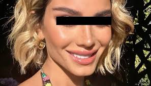 Venados Basketball deja ir su tercer juego al hilo al caer ante los Ángeles  de Ciudad de México.