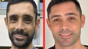 Reece's Liver Transplant Journey