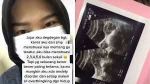 Namun, beberapa kondisi lain memerlukan tindakan lebih lanjut. Viral Kisah Perempuan Telat Haid Selama 10 Bulan Ternyata Karena Ini