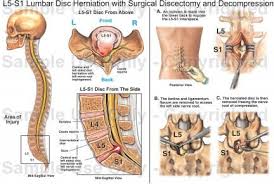 Pin On For My Back Injury