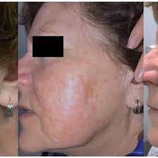 Lauren Lam's research works