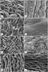 Image result for Bertiera angusiana