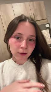 Understanding Under Eye Patches and Their Effectiveness