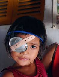 Your gift… their vision