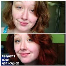 Before And After Henna Red Wine By The Henna Guys Bought On Amazon Henna Hair Dyes Henna Hair Red Henna Hair