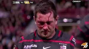 La plus grosse poutine du monde, édité chez bayard sous la direction de carole tremblay, écrit par andrée poulin et réalisé sous la bienveillante supervision de monique dubé. 10 La Plus Grosse Blessure Du Rugby Youtube