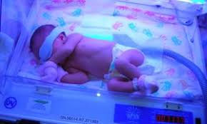 Penyakit kuning, atau jaundice, sebenarnya bukan satu penyakit. 6 Cara Mencegah Bayi Kuning Baru Lahir Tiada Jaundice